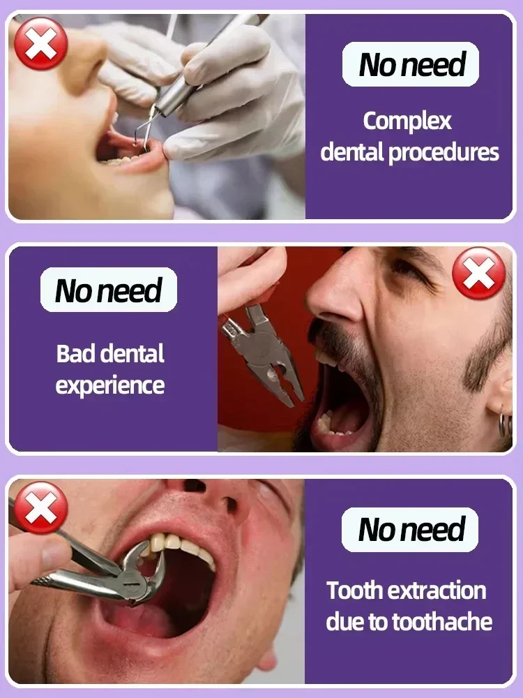 Anti Caries Repairing Cavities Tooth Decay Repair teeth health product
