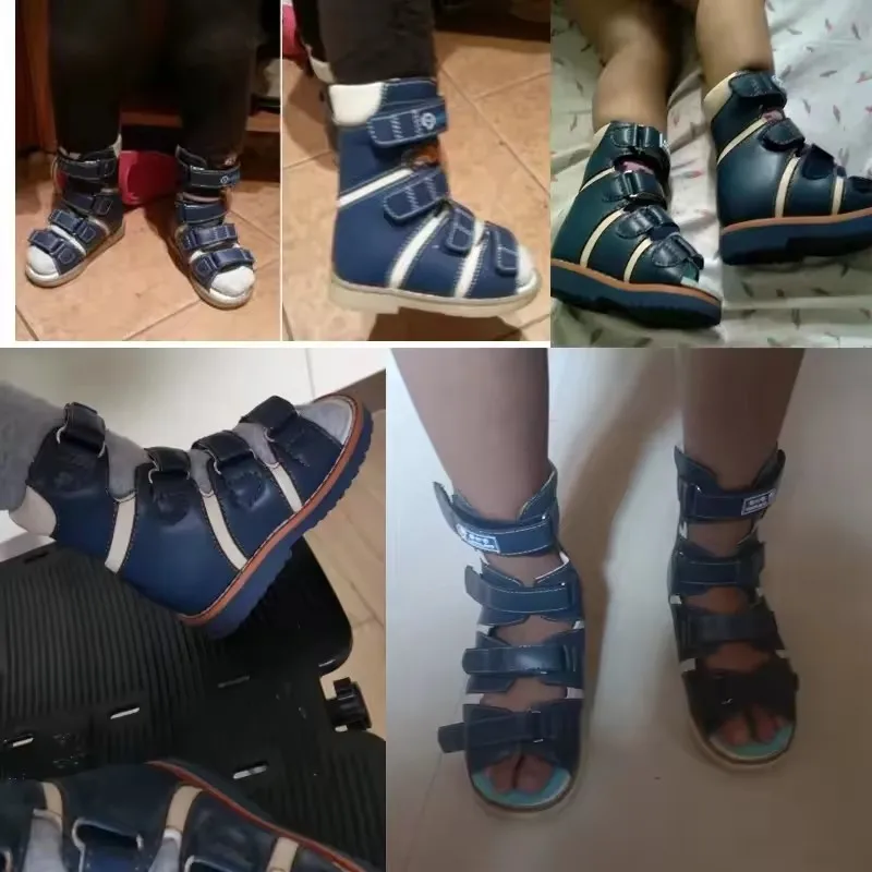 Ortoluckland 어린이 하이 탑 샌들 소년 가죽 정형 신발 어린이를위한 Clubfoot 발목 지원 플랫 피트 신발