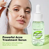 Powerful Acne Treatment Serum Controls Oil Fades Acne Marks Gently Cares Skin Tone Essence Fade Dark Patches Beauty Products