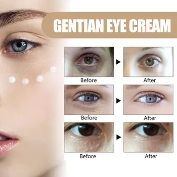 Fat Granules Remover Eye Cream Remove Dark Circles Eye Bags Fade Fine Lines Anti-Puffiness Wrinkles Lift Firming Eye Skin Care - Thumbnail 5