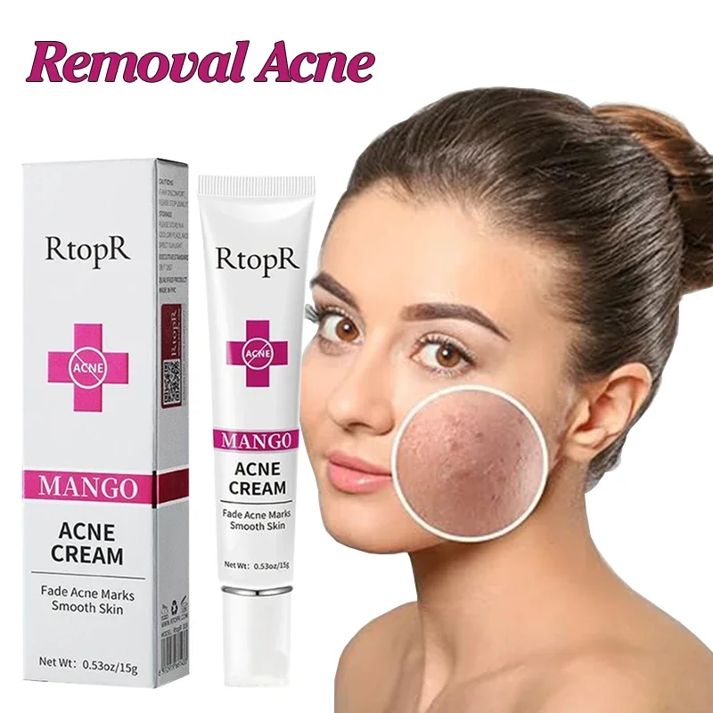 

Acne Cream Acne Mark Removal Acne Mild Repair Damaged Skin Hydration Nourishment Rejuvenation Skin Brightening Skin Care