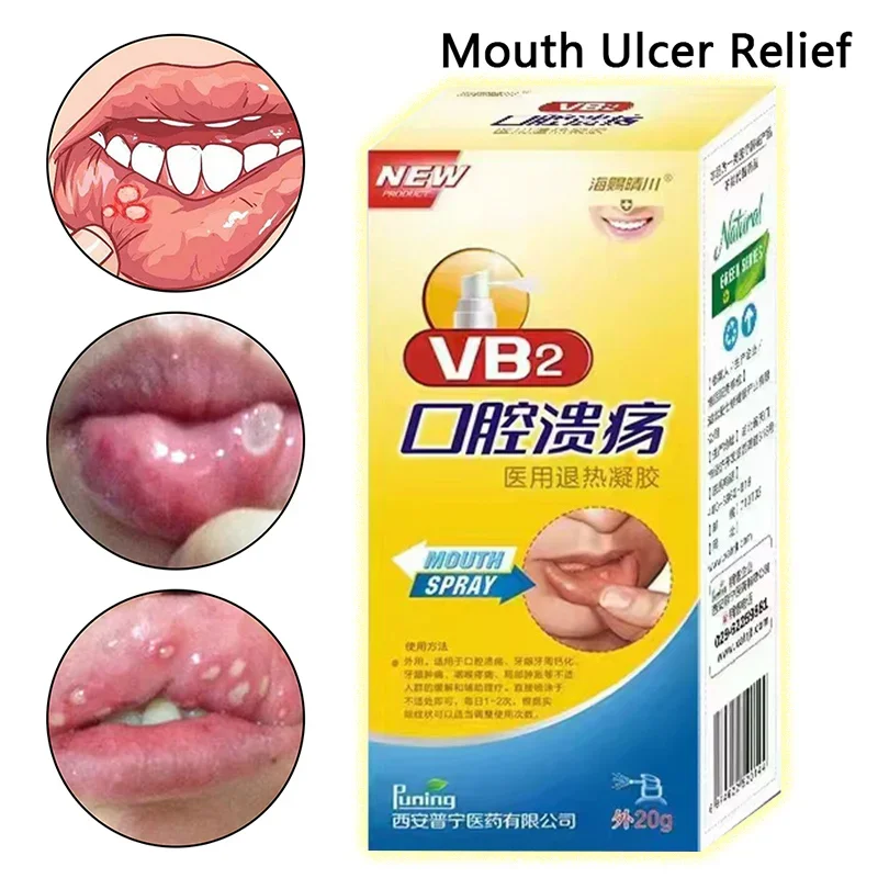 

Natural Herbal Canker Sores Oral Antibacterial Mouth Pharyngitis Pain Effective Treatments Relieve Spray Oral Ulcers