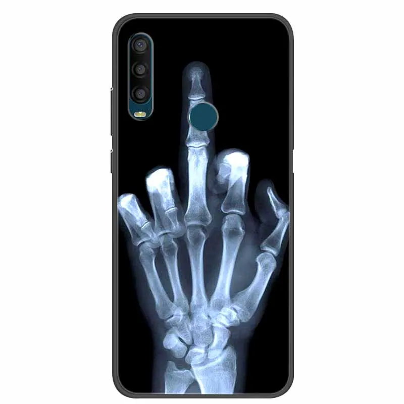 DQG Cover Per Alcatel 3L 2020 (2 Pezzi) + 3 Pellicole In Vetro Temperato - Custodia Morbida Trasparente E Nera TPU, Protezione Schermo HD 9H