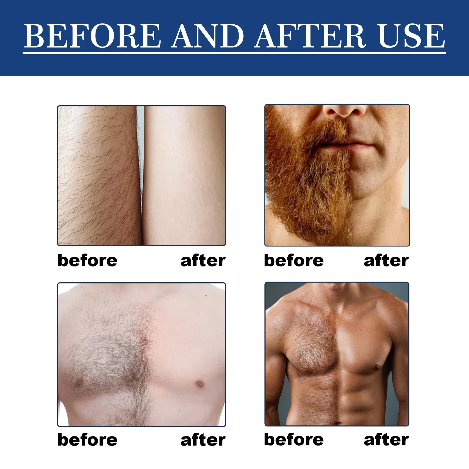Hair Removal Spray for Men - Gentle and Effective, Perfect for Legs, Underarms, Chest Hair - Convenient Spray-On Formula 5