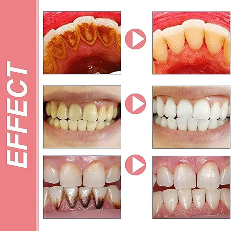 Probiotic Toothpaste Whiten Tooth Remove Plaque Stains Teeth Whitener Oral Hygiene Clean Fresh Breath Teeth Care Products,teeth whitening essence,teeth whitening product,teeth health product