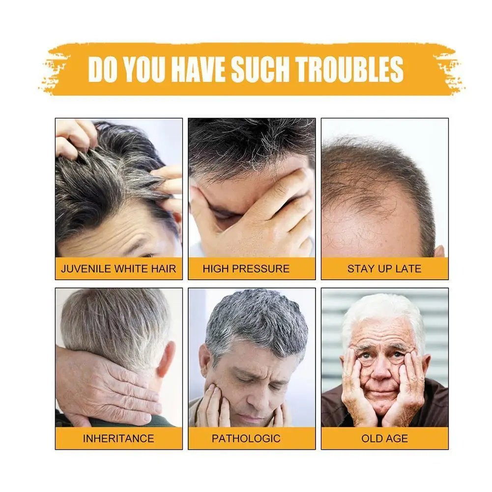 شريط الشامبو الداكن للشعر ، صابون مضاد للقشرة ، تن...