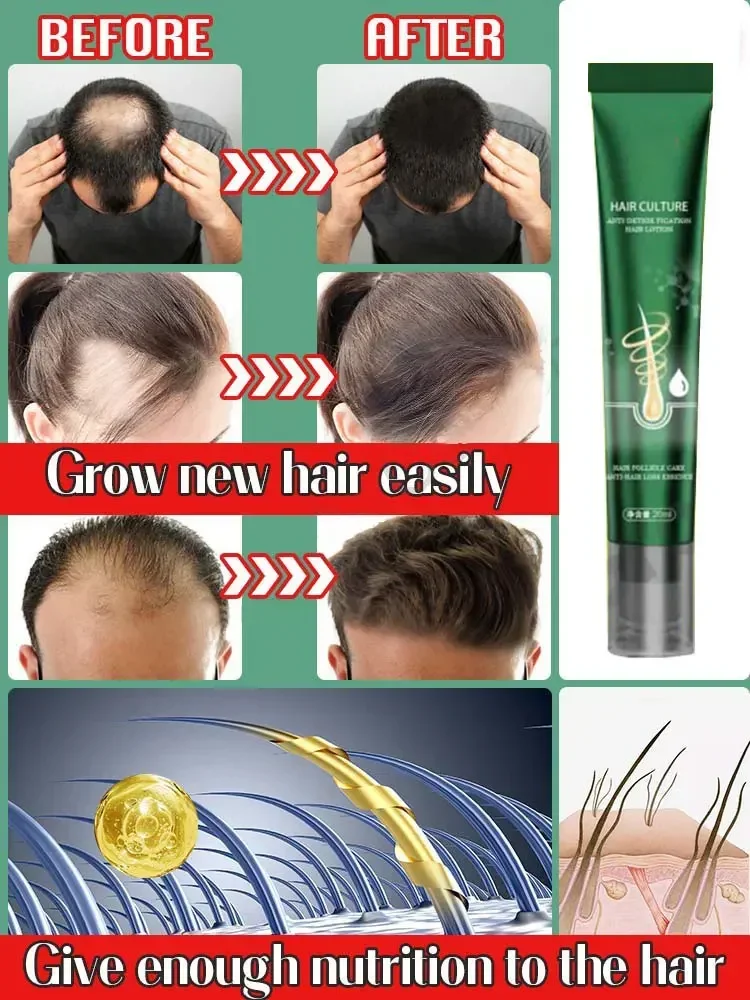 Hair Growth Oil Hair Growth Oil Fast Growing Hair Effective Essential Baldness Repair Hereditary Anti Postpartum Seborrheic Loss Products