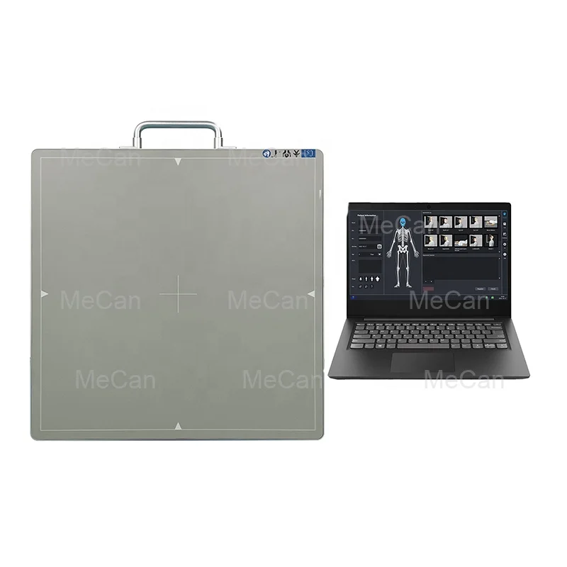 Рисунок 2 - Беспроводной рентгеноскопический