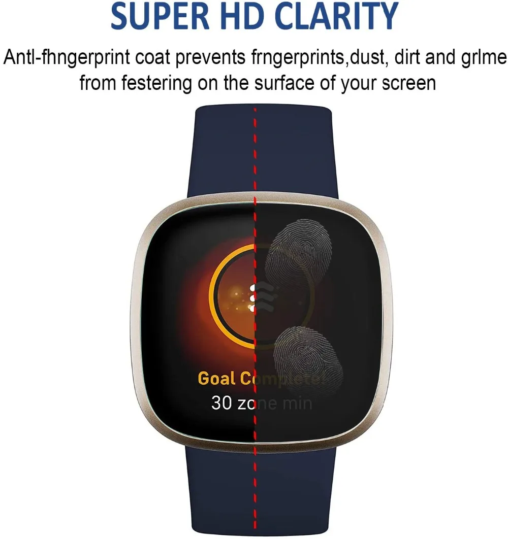 Xplora X6/X5 Play Kids 스마트 시계 X6play X5play 화면 보호기 커버 용 5pcs TPU 소프트 어린이 Smartwatch 보호 필름 가드
