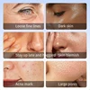Blue Copper 80% Sponge Spicule Microcrystal Freeze-dried Powder Facial Oligopeptide Soothing Repair Mask Firm Moisturizing Skin 2