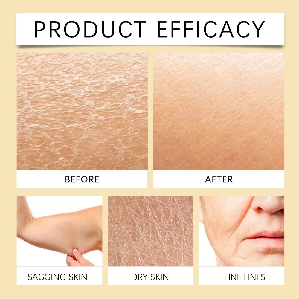 50% Oat 2% Salicylic Acid 2.76inch Urea Moisturizing Cream Tea Tree Aloe Vera Moisturizing Cream Hyaluronic Acid Oatmeal