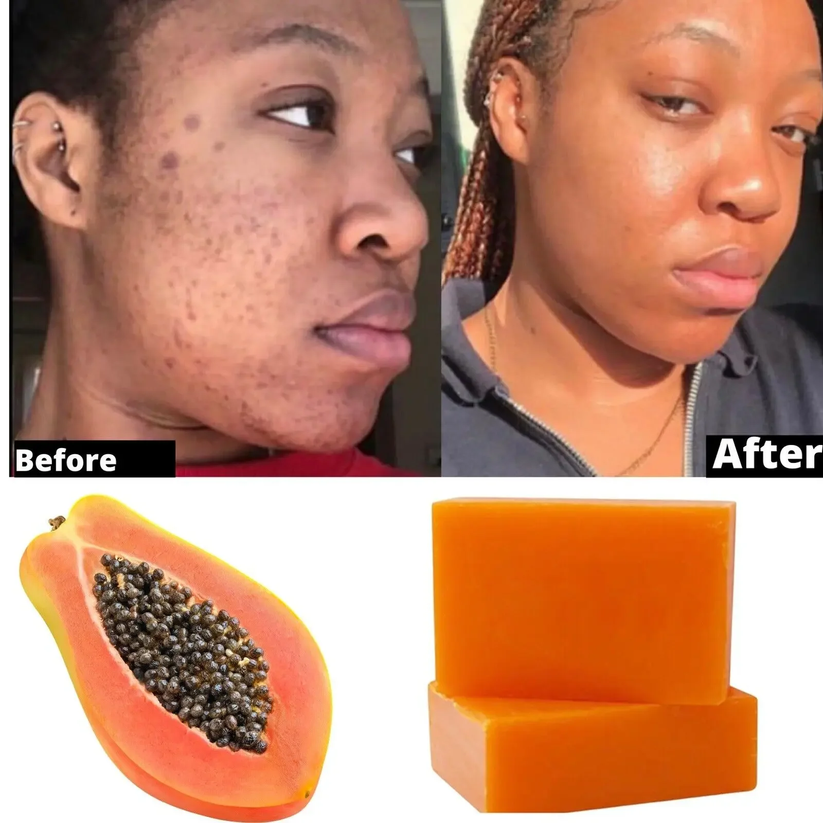 

Kojic Acid Bar Soap, Dark Spot Remover, Lightening Bar Soap, Glowing Skin Promotion