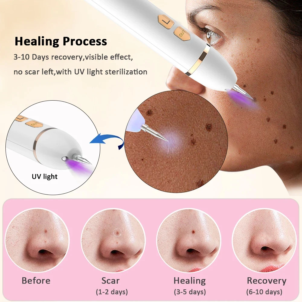 Plasma Laser Pen Skin Tag Remover Wart Mole Spots Freckles Dark Dpot Black Dots Nevus Flat Blemish Pimples Removal Face Body