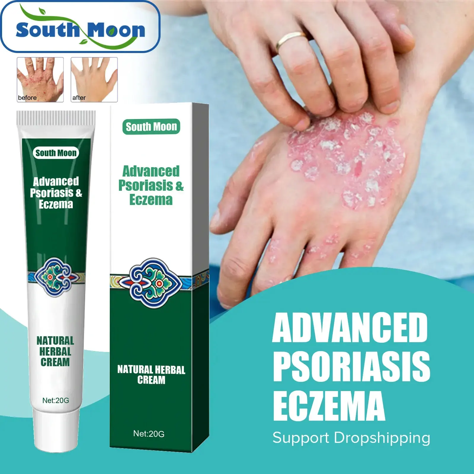 

South Moon Psoriasis Ointment Eczema Herbal Cream Treatment Urticaria Desquamation Antibacterial Anti-Itching Health Skin Care