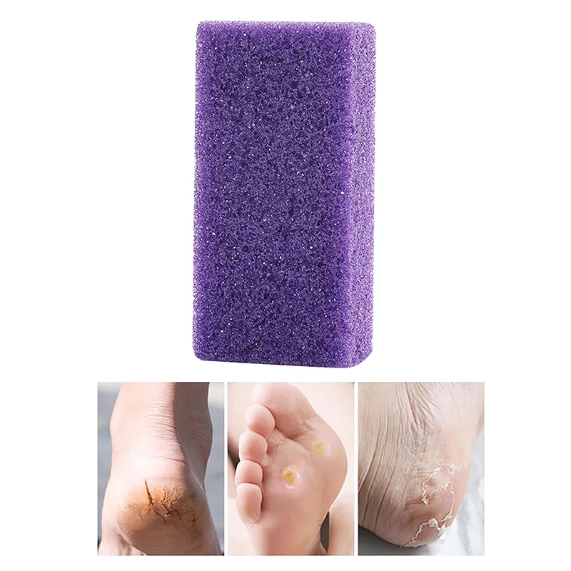 ExfoliateFeetPedicureHandlePumiceStoneScraperFootFileDeadHard
