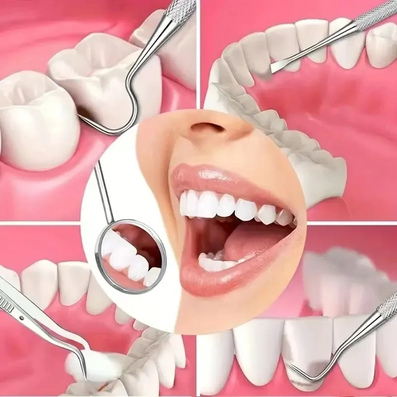 Stainless Steel Dental Care Kit 6