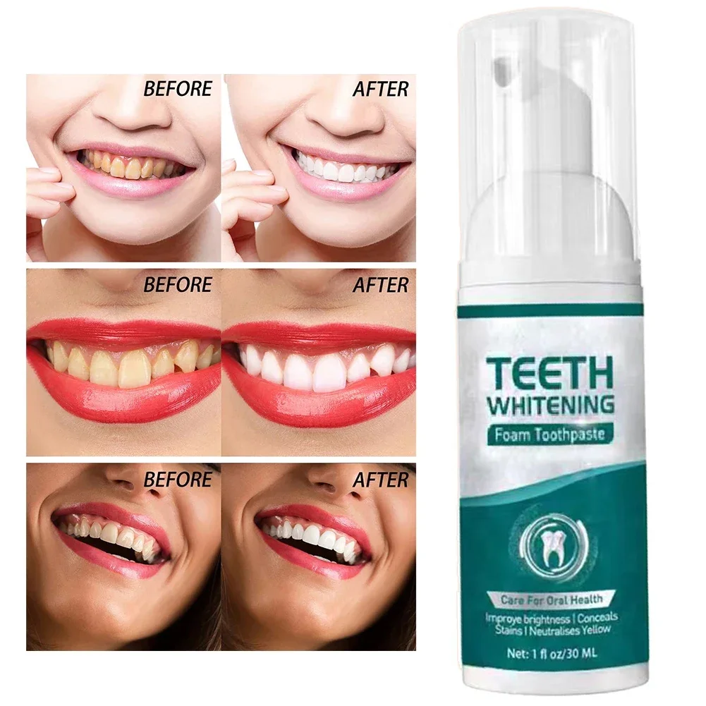 Teeth Whitening Product Tooth Decay Repair