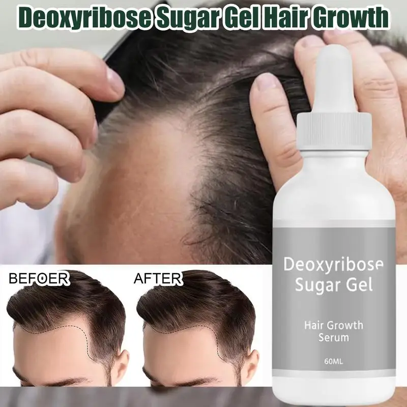 Hair Growth Oil 60ml Hair Thickening Gel Deoxyribose Gel for Growth