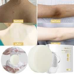 Body Whitening Soap Private Parts Underarm Knee Bleaching Soap Whiten Butt Chicken Skin Removal Dark Spot Brighten Body Care 50g