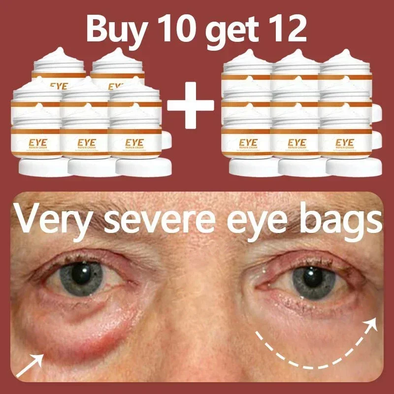 Buy10 get 12 free