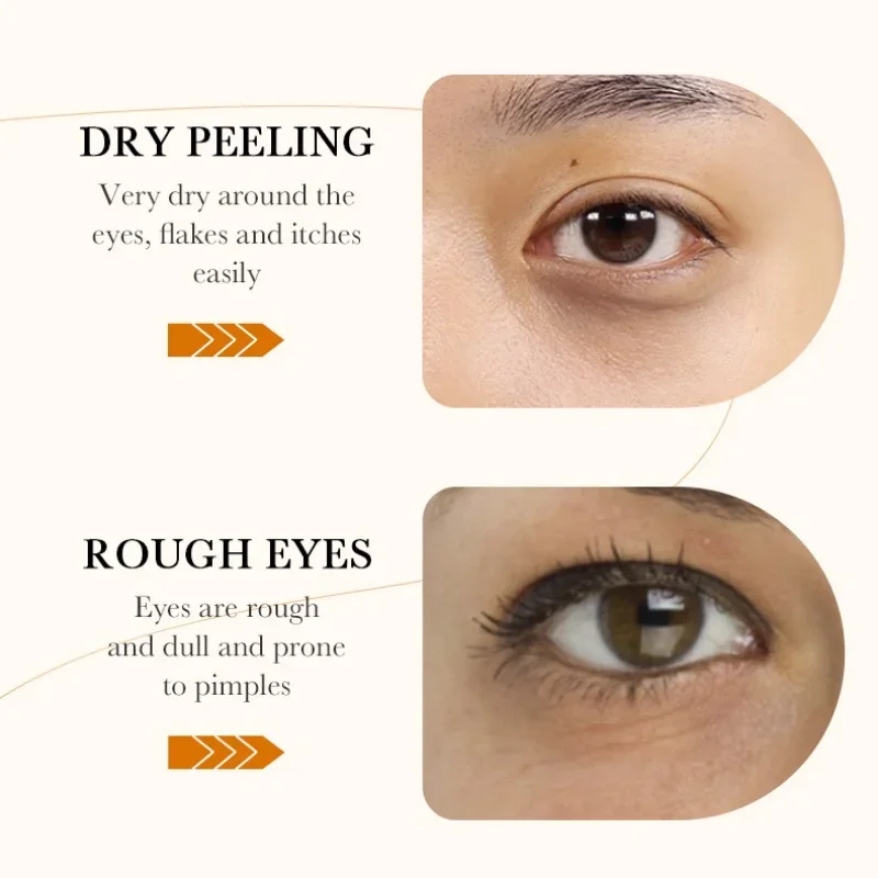 Rice Eye Mask 60pcs BIOAQUA Raw Pulp Anti Dark Circles Eyes Bags Remover Firming Moisturizing