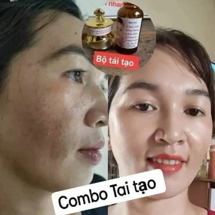 Thailand Brightening Cream with Tea Tree Extract Set Reduces Puffiness Smoothes Skin Minimizes Pores Skin Care for Beauty Salons