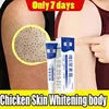 Keratosis Pilaris Cream – Smooth & Clear Skin