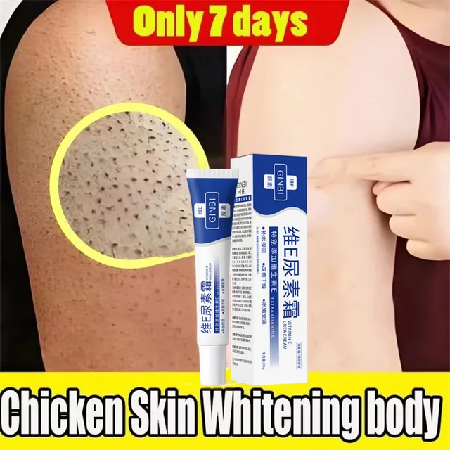 Keratosis Pilaris Cream – Smooth & Clear Skin