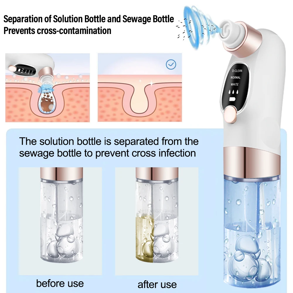 Electric Blackhead Remover Vacuum Facial Pore Cleaner Rechargeable Deep Dirt Skin Cleaning Machine for Pimple Blackhead Removal 6