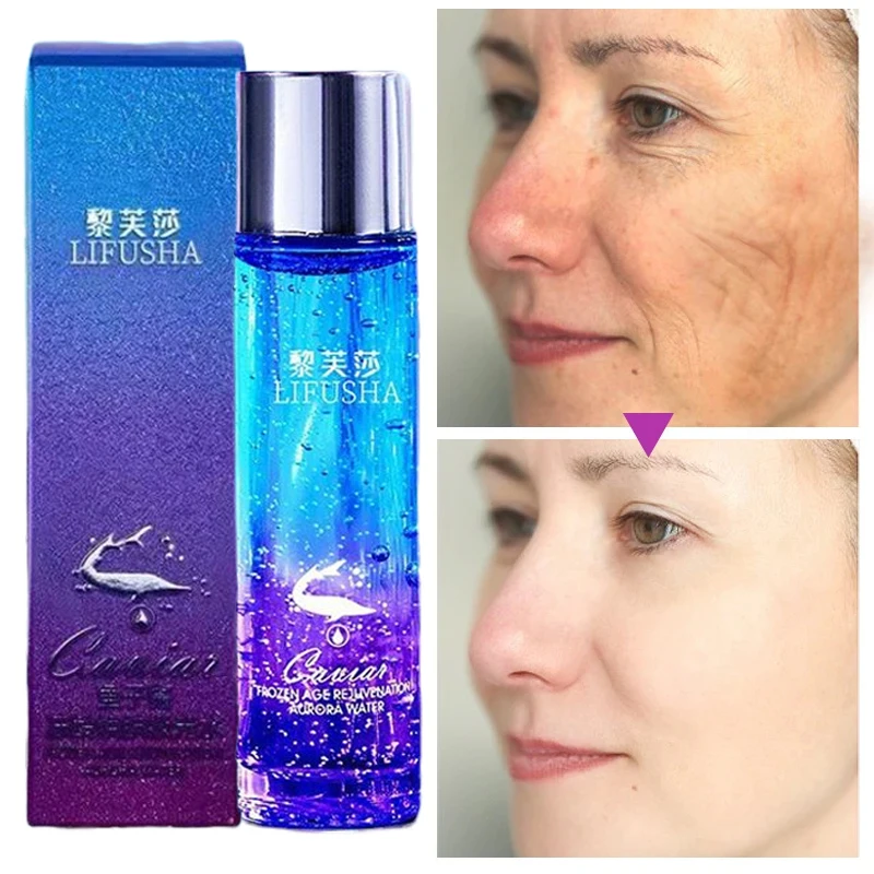 Caviar Anti-Wrinkle Serum Auroral Water Moist Moisture Fade Fine Lines Brighten Skin Tone Toner Oil Control Compact Facial Care