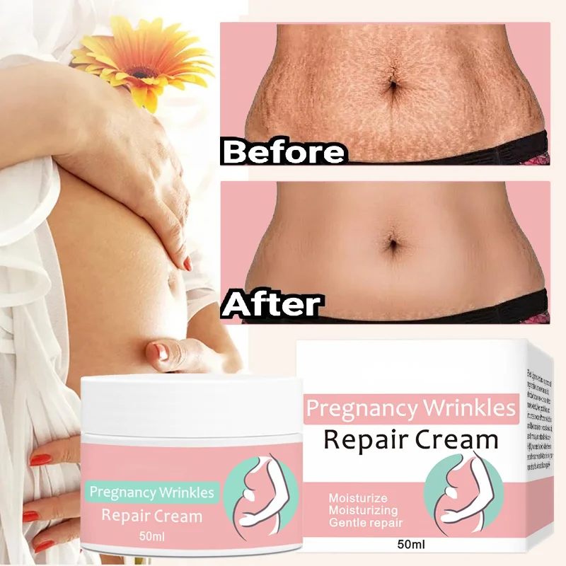 Pregnancy firming skin repairing cream after pregnancy