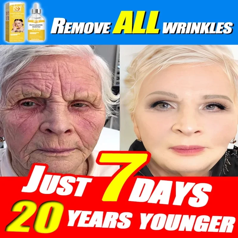 Revitalize your skin with our Anti-Aging Serum Neck Wrinkle Remover 1