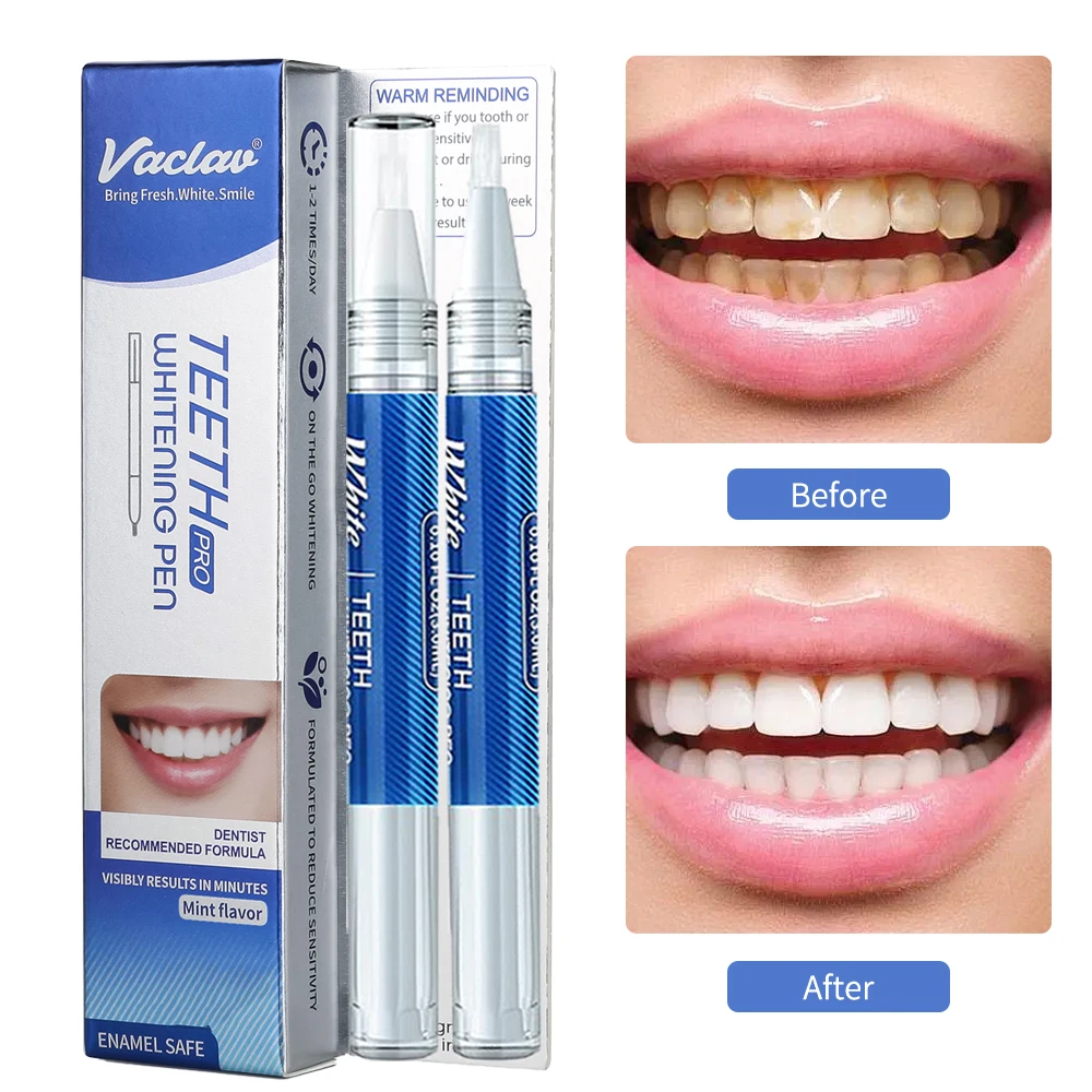 Vaclav Teeth Whitening Pen Tooth Whitening Gel Tooth Bleach Gel Whitener Remove Stains Oral Hygene