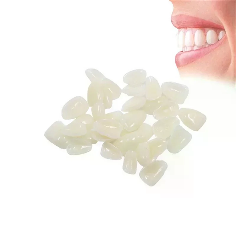 Faccette Dentali Temporanee per Sbiancamento, Membrane Dentali con Faccette Sbiancanti Ultra Sottili in Resina per Denti Anteriori