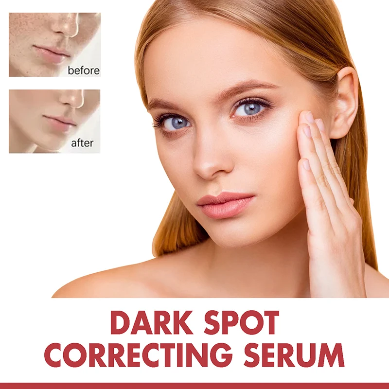 Dark Correcting Essence 10% Niacinamide+ 4% Tranexamic For Post-Acne Marks Acne Hyperpigmentation Even Skin Tone Serum facial essence
