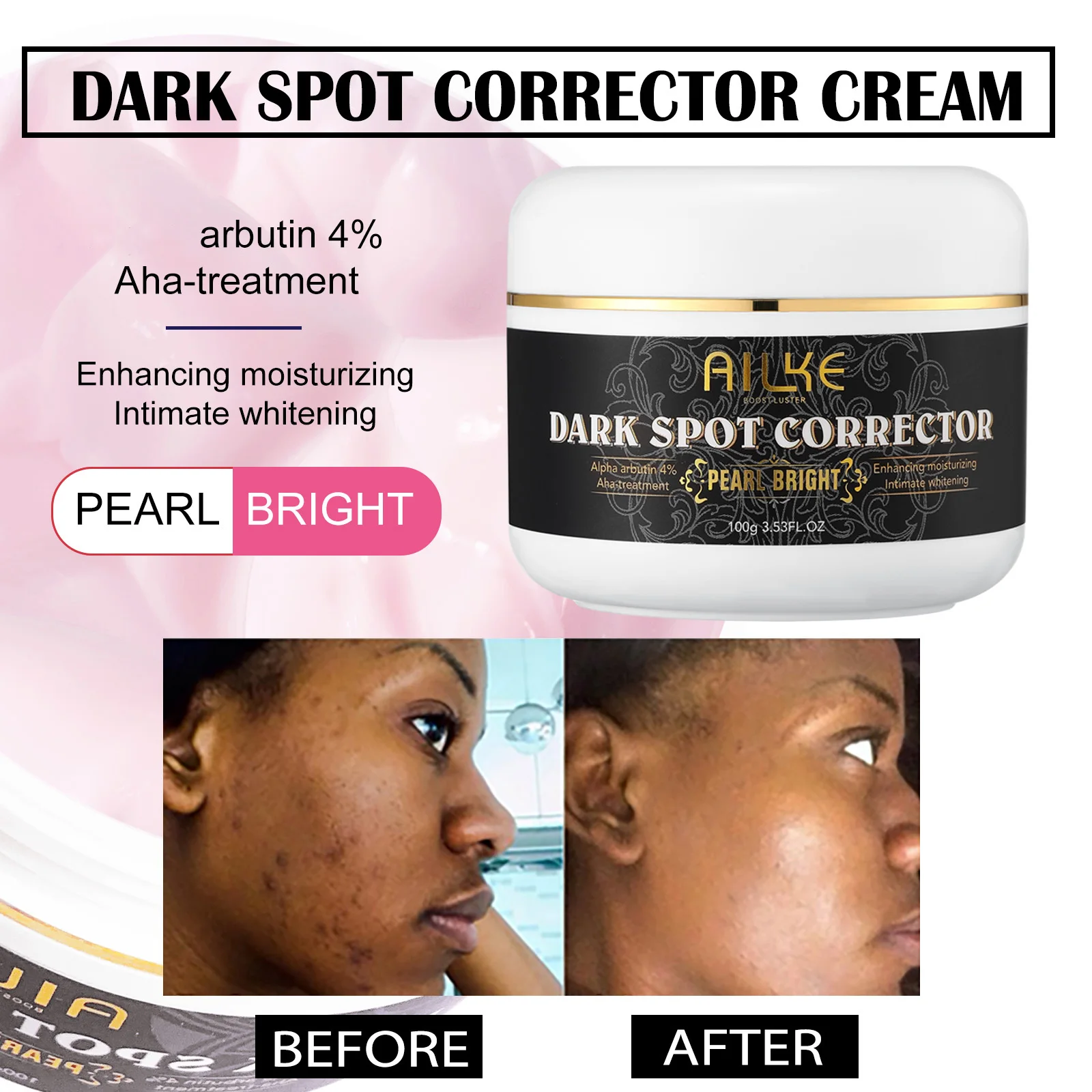 Spot Remove Cream