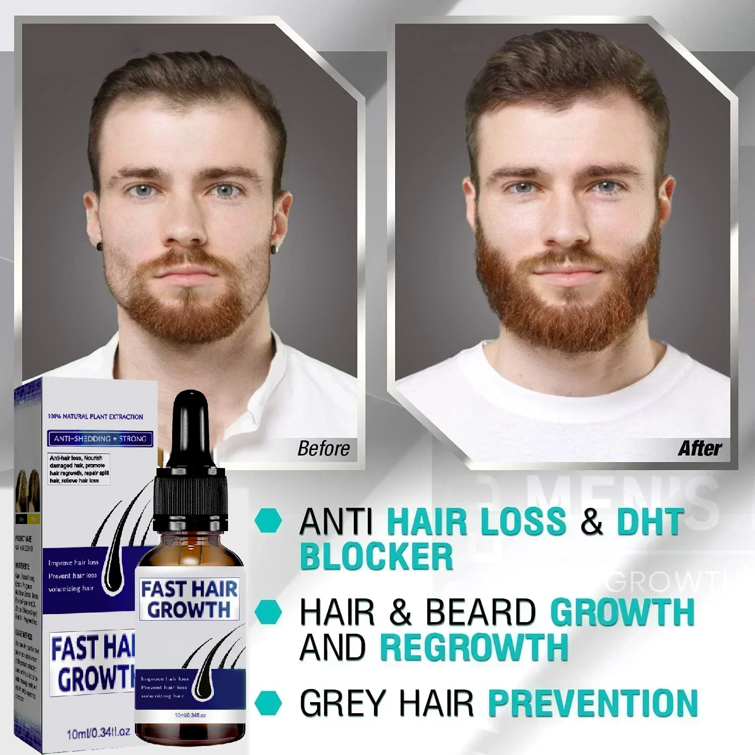 Biotin Hair Spray for Man Women 20ml Repair Damage Restore Oil Scalp Repair Serum Thicken Hair Health Care, hair care products