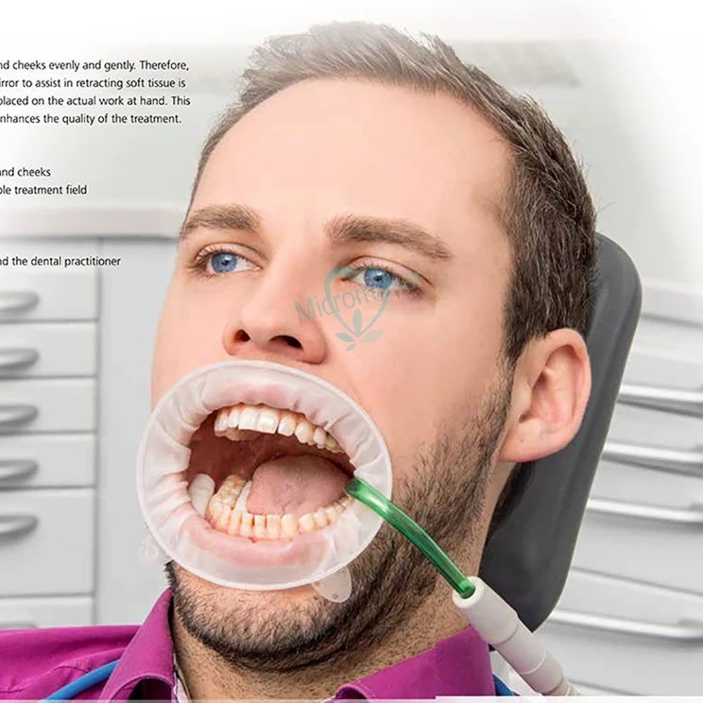 AbridordebocaDentalRetractordelabiosmejilla3DformadeO