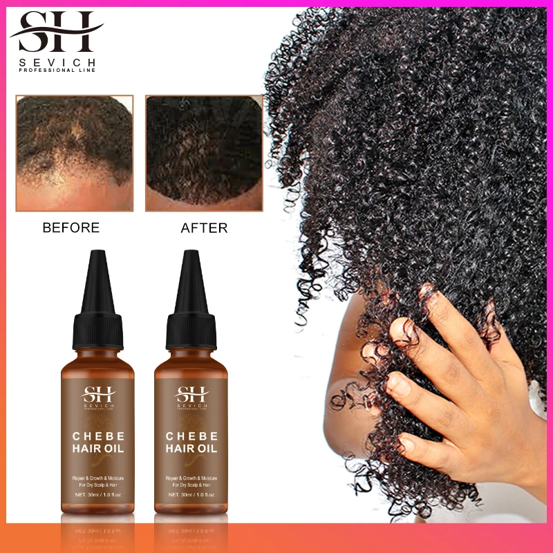 Sevich Africa Traction Alopecia Chebe Hair Thickening Set 30ml Hair Growth Oil Fast Growing 100g Butter Strong Root