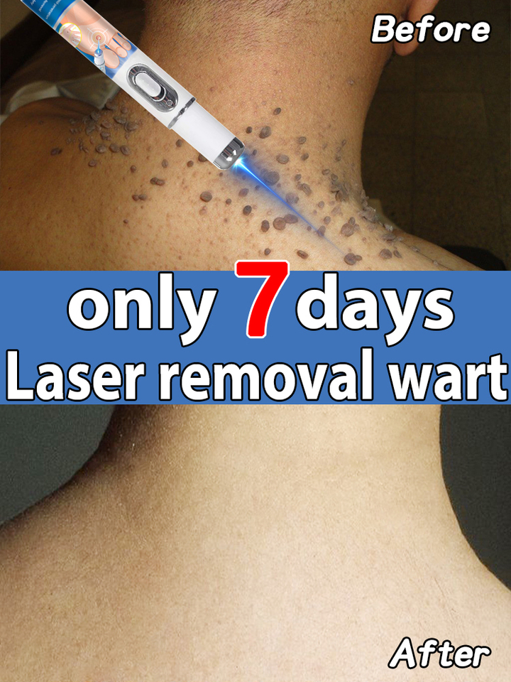 Pʀᴏғᴇssɪᴏɴᴀʟ sᴏʟᴜᴛɪᴏɴ ᴛᴏ sᴋɪɴ ᴘʀᴏʙʟᴇᴍs