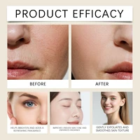 Crème pour le corps à lueur de fraise avec Niacinamide acide salicylique exfoliant hydratant peau lisse Non grasse hydratant cadeau de vacances 2