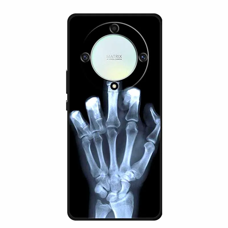 Shockproof Soft TPU Silicone Back Cover for Huawei Honor X9A - Durable Protective Phone Case