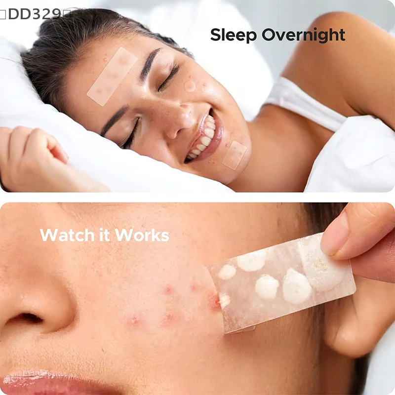 〔DD329〕Hydrocolloid Acne Patch Invisible Closed Mouth Acne Face Invisible Waterproof Breathable Skin Patch Skin Care Tool