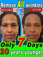 Restore your beautiful appearance 1