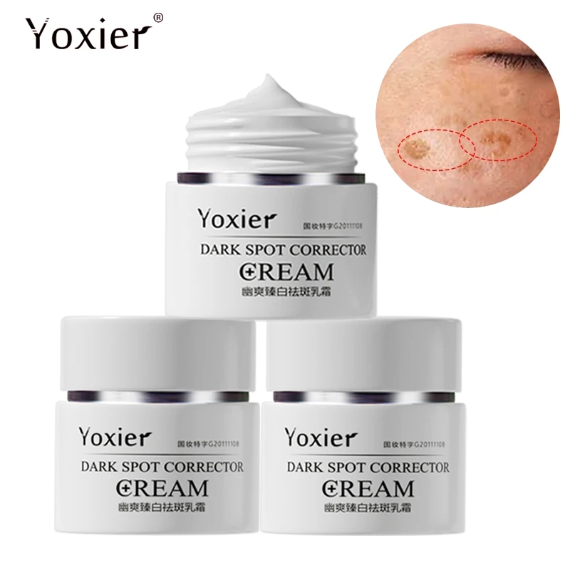 Dark Spot Face Cream Hydrating Corrector Remove Freckles Age Sunburn
