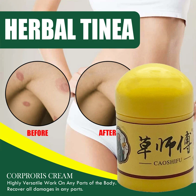 Skin Care Ointment 10g CaoShiFu Eczema Treatment Ointment Antibacterial Psoriasis Cream Anti-Itching Antipruritic Skin Care Herbal Plaster