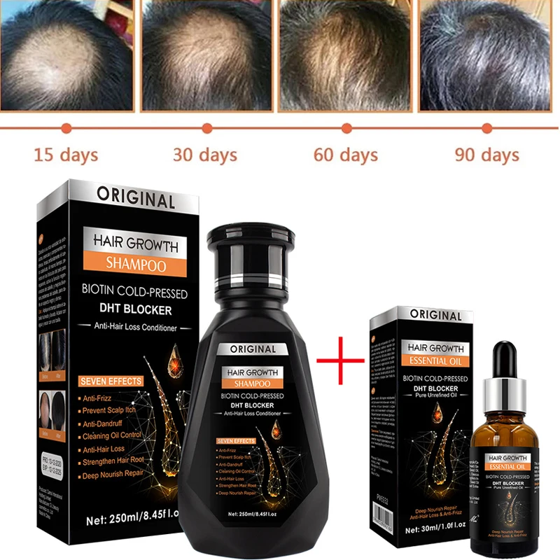 Hair Growth Essential Oil Biotin Cold-pressed Dht Blocker And Hair Growth  Shampoo Anti-hair Loss Conditioner - Hair Loss Product Series - AliExpress