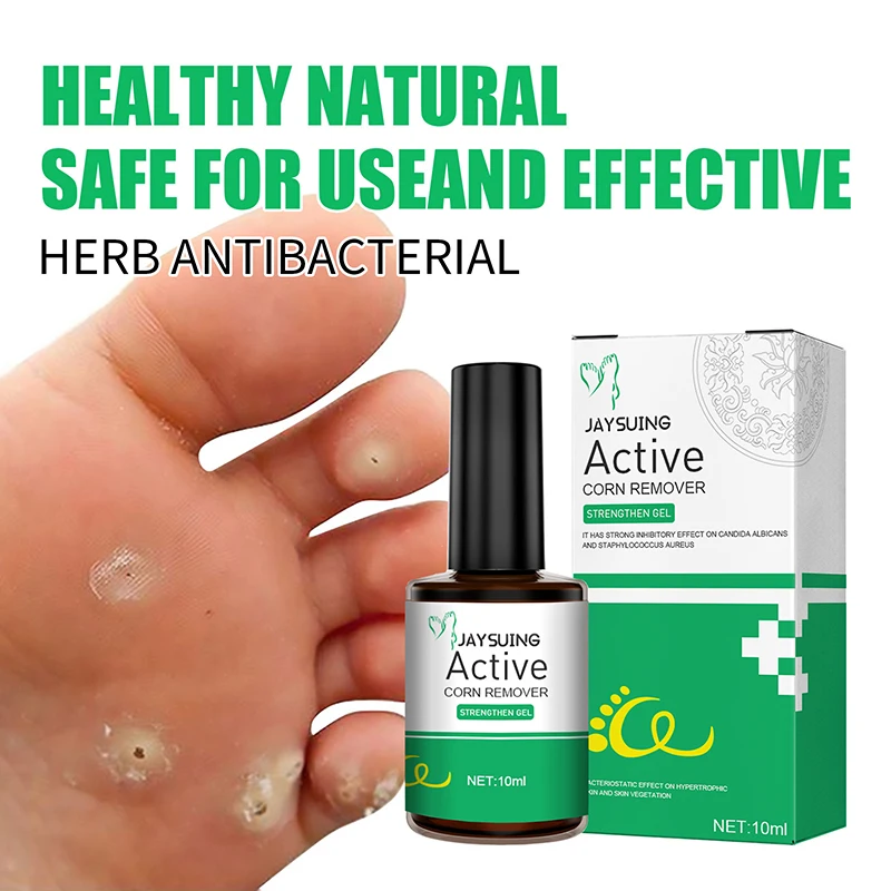10ml Remove Foot Corn Care Cream Remove Foot Calluses Remove Warts