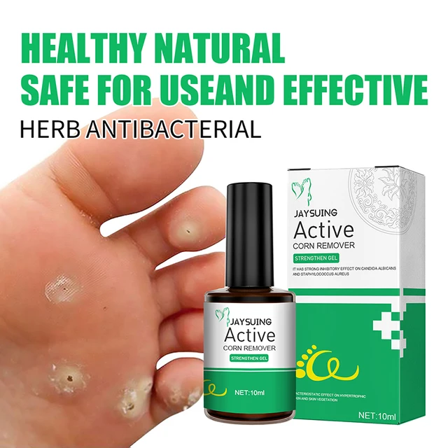 10ml Remove Foot Corn Care Cream Remove Foot Calluses Remove Warts