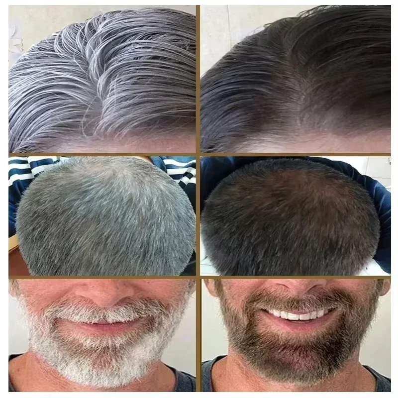 Siero Naturale Anti-Grigio per Capelli | Remedio Nutriente per la Cura dei Capelli - Ripara i Capelli Bianchi e Oscuranti - immagine 3